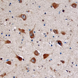 DOC2A Antibody in Immunohistochemistry (Paraffin) (IHC (P))