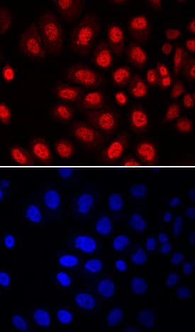MSX2 Antibody in Immunocytochemistry (ICC/IF)