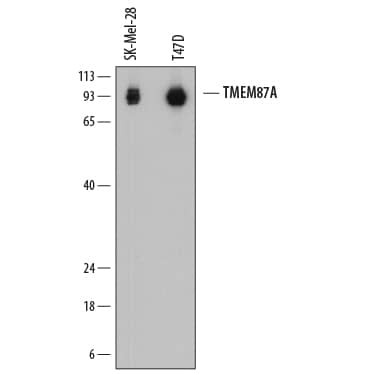 TMEM87A Antibody in Western Blot (WB)