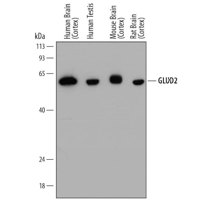 GluD1/GluD2 Antibody in Western Blot (WB)