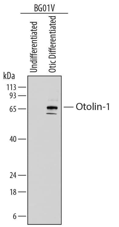 OTOL1 Antibody in Western Blot (WB)