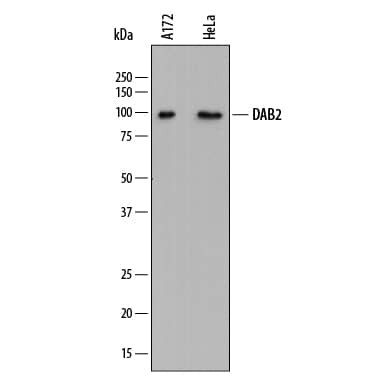 DAB2 Antibody in Western Blot (WB)
