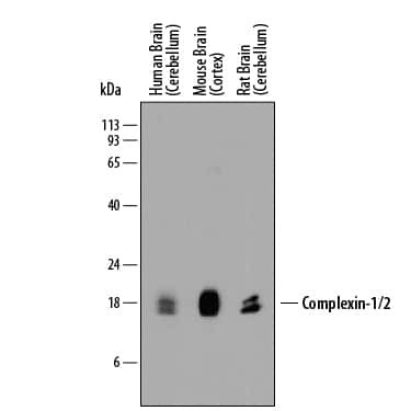 CPLX1/2 Antibody in Western Blot (WB)