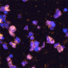 HHLA2 Antibody in Immunocytochemistry (ICC/IF)