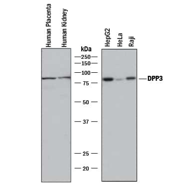 DPP3 Antibody in Western Blot (WB)