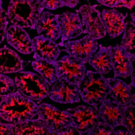 PTCH2 Antibody in Immunohistochemistry (Frozen) (IHC (F))