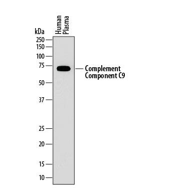 Complement C9 Antibody in Western Blot (WB)