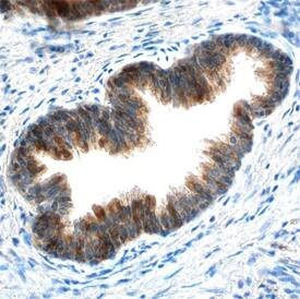 cIAP1 Antibody in Immunohistochemistry (Paraffin) (IHC (P))