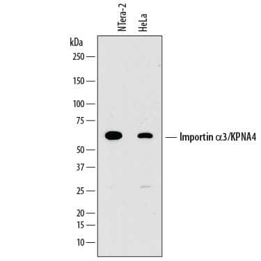 KPNA4 Antibody in Western Blot (WB)