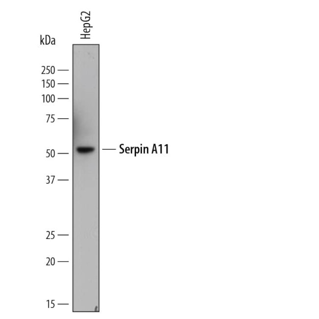 SERPINA11 Antibody in Western Blot (WB)