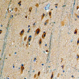 DRD5 Antibody in Immunohistochemistry (Paraffin) (IHC (P))