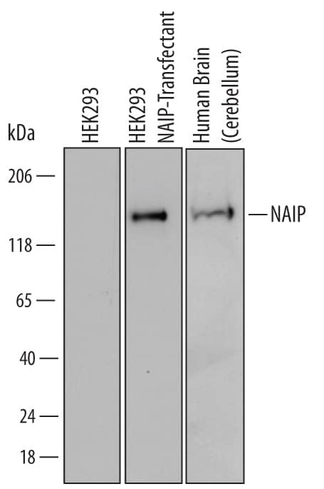 NAIP Antibody in Western Blot (WB)