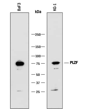 PLZF Antibody in Western Blot (WB)