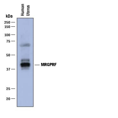 MRGPRF Antibody in Western Blot (WB)