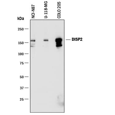 DISP2 Antibody in Western Blot (WB)