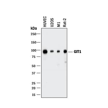 GIT1 Antibody in Western Blot (WB)