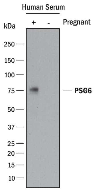PSG6 Antibody in Western Blot (WB)