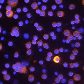 Caspase 4 Antibody in Immunocytochemistry (ICC/IF)