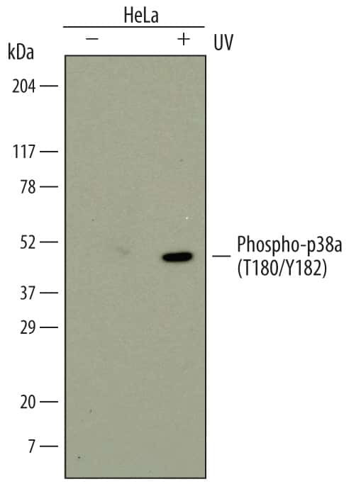 Phospho-p38 MAPK alpha (Thr180, Tyr182) Antibody in Western Blot (WB)