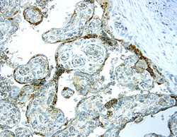 IGFBP5 Antibody in Immunohistochemistry (Paraffin) (IHC (P))