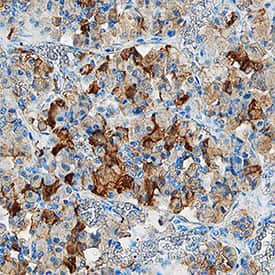Chromogranin B Antibody in Immunohistochemistry (Paraffin) (IHC (P))