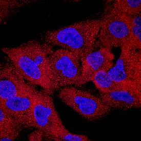 SH3KBP1 Antibody in Immunocytochemistry (ICC/IF)
