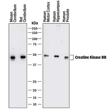 Creatine Kinase BB Antibody in Western Blot (WB)