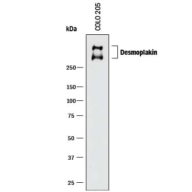 Desmoplakin Antibody in Western Blot (WB)