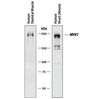 MYH7 Antibody in Western Blot (WB)
