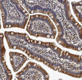 IFNL4 Antibody in Immunohistochemistry (Paraffin) (IHC (P))