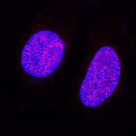 ATAD2 Antibody in Immunocytochemistry (ICC/IF)