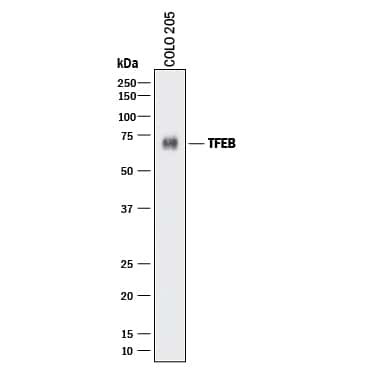 TFEB Antibody in Western Blot (WB)