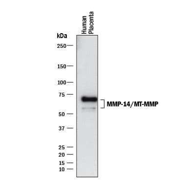 MMP14 Antibody in Western Blot (WB)