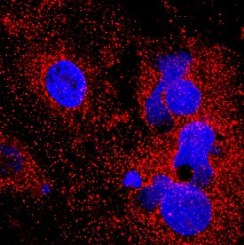 ORM2 Antibody in Immunocytochemistry (ICC/IF)