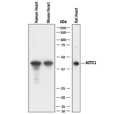 alpha-Cardiac Actin Antibody in Western Blot (WB)