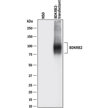 BDKRB2 Antibody in Western Blot (WB)