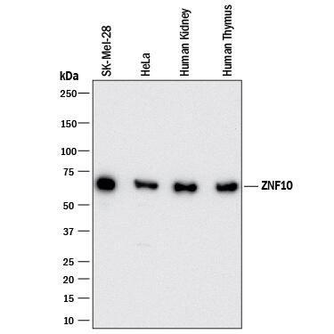 ZNF10 Antibody in Western Blot (WB)
