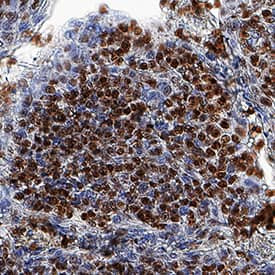 ZNF10 Antibody in Immunohistochemistry (Paraffin) (IHC (P))