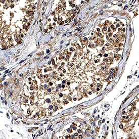 DNAH17 Antibody in Immunohistochemistry (Paraffin) (IHC (P))