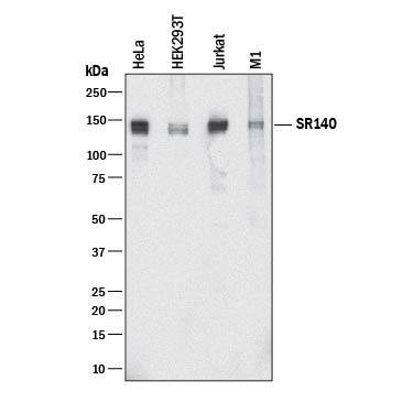 SR140 Antibody in Western Blot (WB)