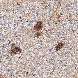 Neurophysin II Antibody in Immunohistochemistry (Paraffin) (IHC (P))