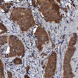 Prostaglandin E Receptor EP1 Antibody in Immunohistochemistry (Paraffin) (IHC (P))