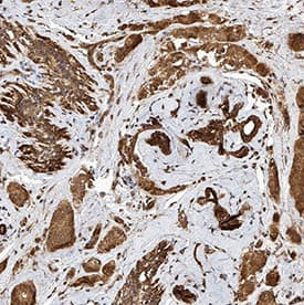 Prostaglandin E Receptor EP1 Antibody in Immunohistochemistry (Paraffin) (IHC (P))