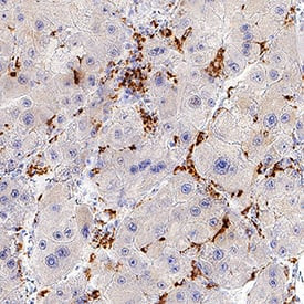 CETP Antibody in Immunohistochemistry (Paraffin) (IHC (P))