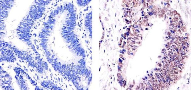 E2F4 Antibody in Immunohistochemistry (Paraffin) (IHC (P))