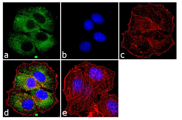 Phospho-ErbB2 (HER-2) (Tyr1248) Antibody in Immunocytochemistry (ICC/IF)