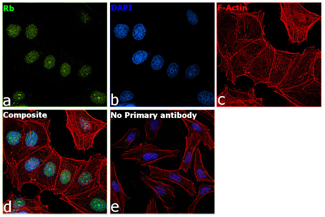 Rb Antibody in Immunocytochemistry (ICC/IF)
