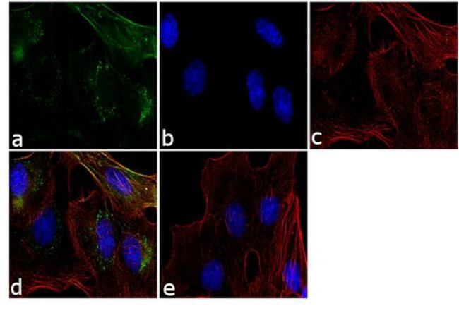 CA125 Antibody in Immunocytochemistry (ICC/IF)