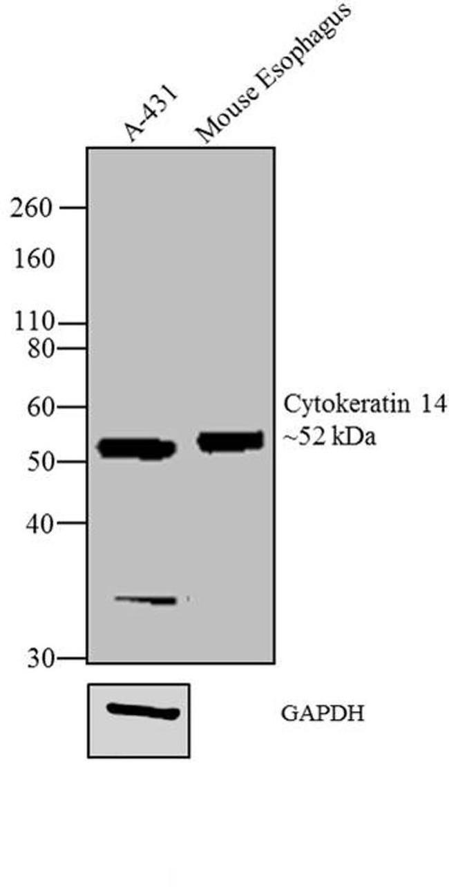 Cytokeratin 14 Antibody in Western Blot (WB)