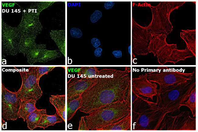 VEGF Antibody in Immunocytochemistry (ICC/IF)